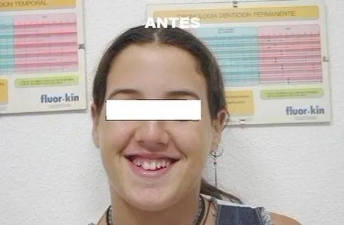 imgi_18_141525-88-clinica-dental-jose-pinilla-melguizo-tratamientos-3-1_image-640w