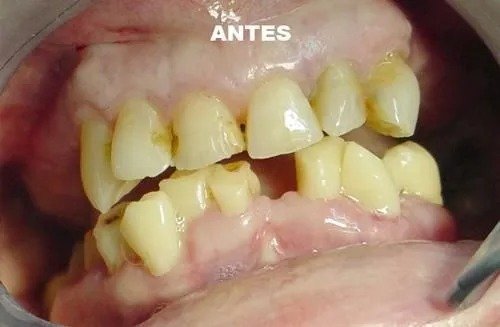imgi_19_141527-92-clinica-dental-jose-pinilla-melguizo-tratamientos-4-1_image-640w
