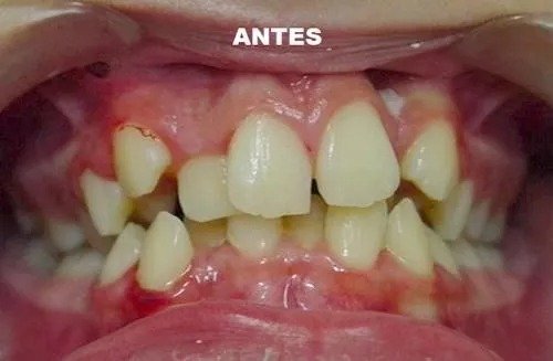 imgi_21_141531-95-clinica-dental-jose-pinilla-melguizo-tratamientos-5-1_image-640w
