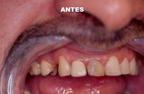 imgi_28_141515-84-clinica-dental-jose-pinilla-melguizo-tratamientos-1-1_image