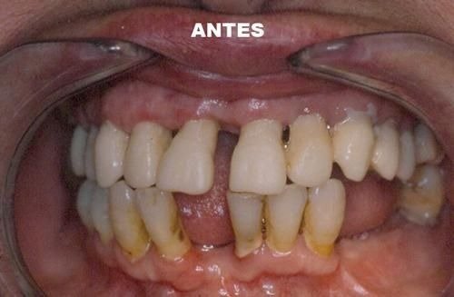 imgi_32_141518-86-clinica-dental-jose-pinilla-melguizo-tratamientos-2-1_image