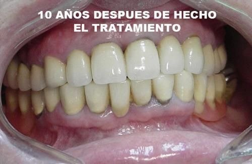 imgi_34_141519-87-clinica-dental-jose-pinilla-melguizo-tratamientos-2-2_image1