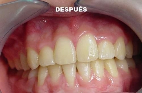 imgi_46_141532-96-clinica-dental-jose-pinilla-melguizo-tratamientos-5-2_image1