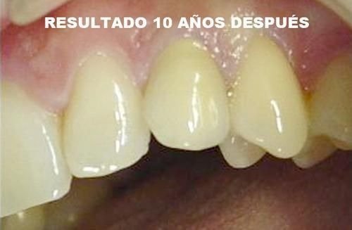 imgi_50_141535-98-clinica-dental-jose-pinilla-melguizo-tratamientos-6-2_image